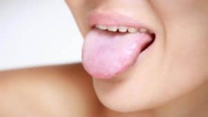 Hal-Hal yang Menyebabkan Sariawan di Lidah